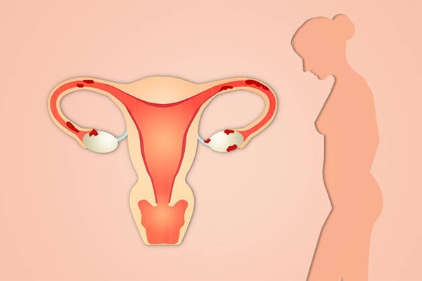 美国南加州生殖中心